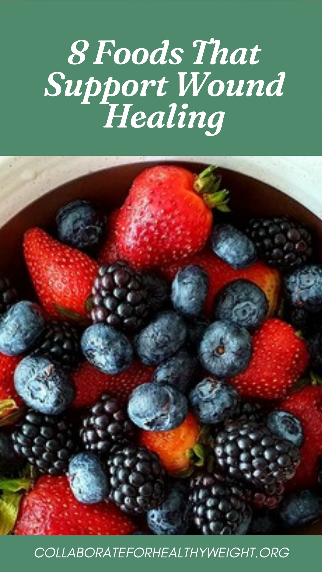8 Foods That Support Wound Healing Pinterest pin