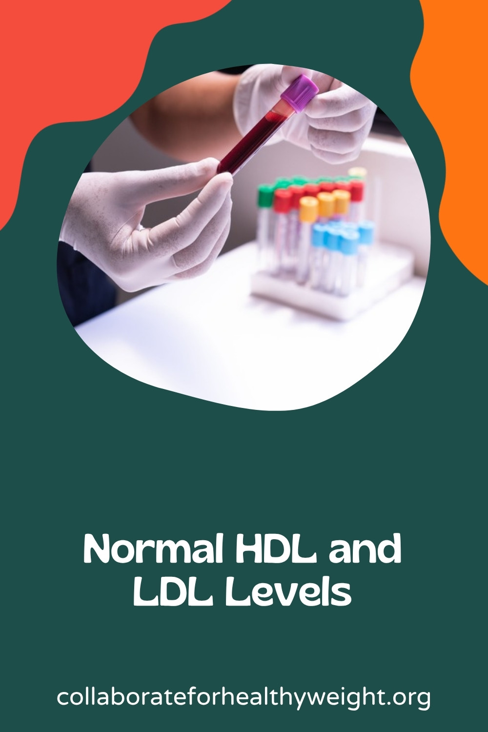 Normal HDL and LDL levels Pinterest pin